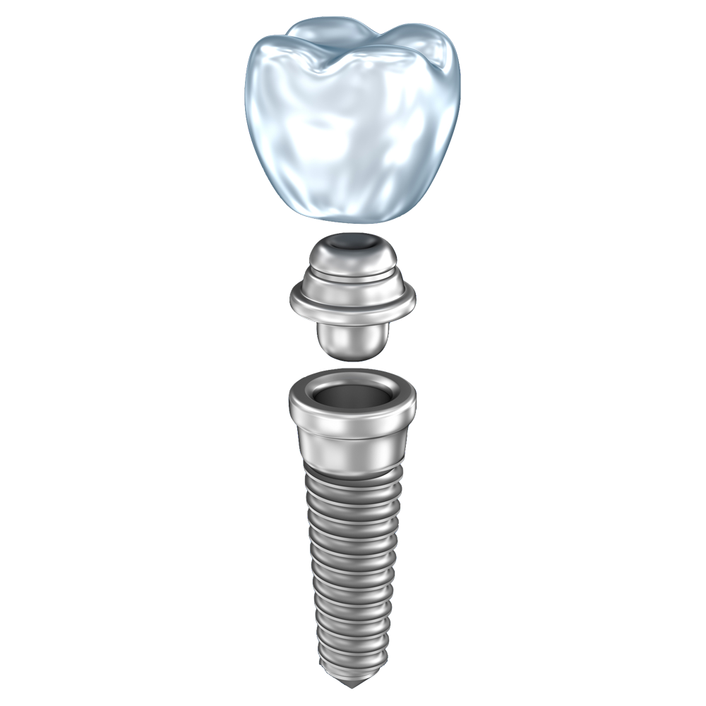 Dental Implant Transparent Image