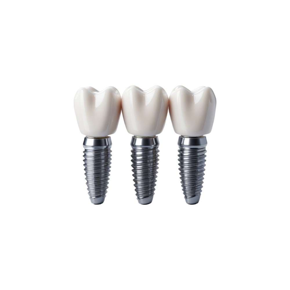 Dental Implant Transparent Photo