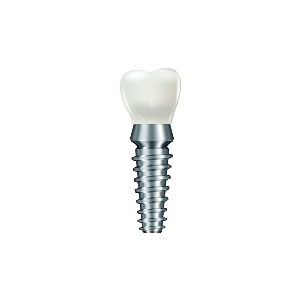 Dental Implant Transparent Gallery