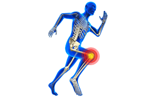 Joint Pain PNG