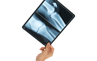 X Ray PNG